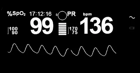 White symbol graph of electrocardiogram ecg in hospital surgery operating Stock Footage 105639208