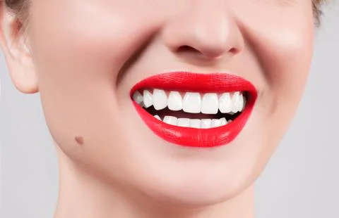 White teeth and red lips. Perfect female smile after bleaching. Dental care a Фото