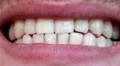 White teeth HD Footage