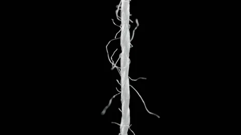 White Thread On Black Background Macro Stock-Footage 93229926