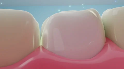 Whitening teeth Video stock 246614321