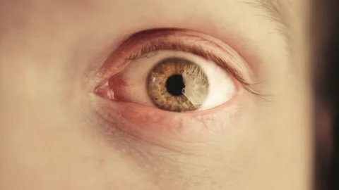 Wide open eye. Constriction of the pupil. Man with green eyes looks ahead with Stock Footage 142177591