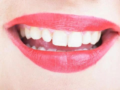 Wide Open Lips Smiling Stock Photos