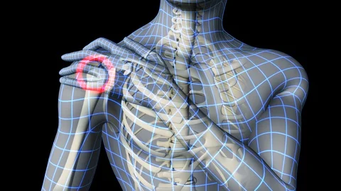 Wireframe Man With Shoulder Pain Video stock 114455256