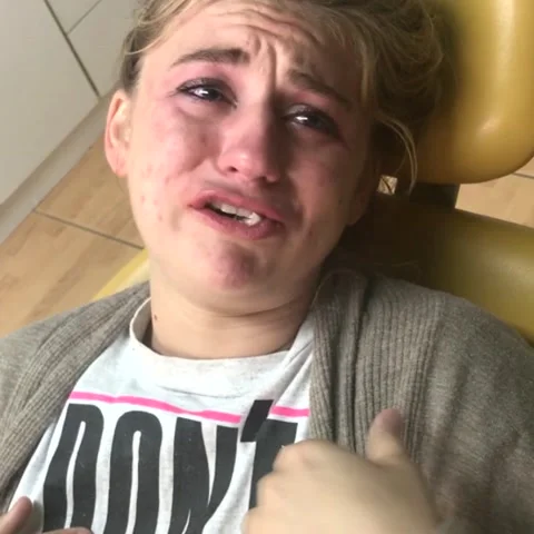 Wisdom Teeth Anesthesia, Managua, Stock Video Pond5