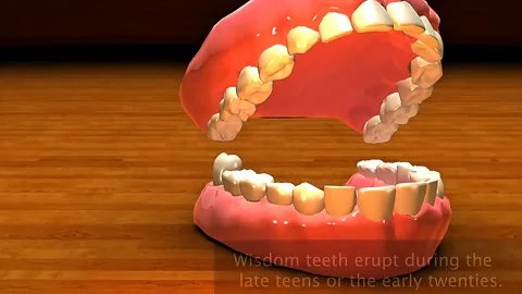 Wisdom Teeth Stock Footage 322539864