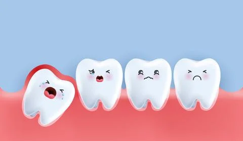 Wisdom teeth under the gums cause pain in the mouth. Impacted wisdom tooth .. Illustrazione stock