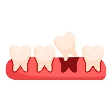 Wisdom tooth growing causing inflammation and pain イラスト素材