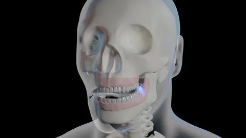 Wisdom Tooth Inflammation Stock-Footage 122122268