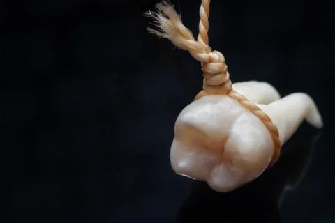 A wisdom tooth Stock Photos