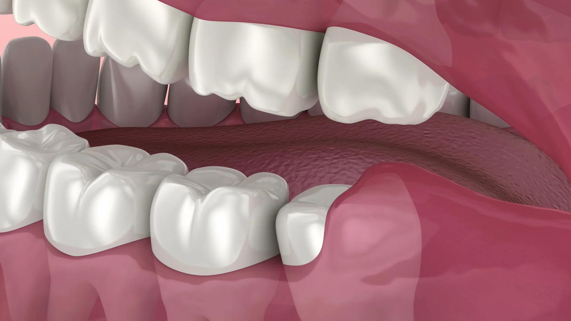 Wisdom Tooth Background Images, HD Pictures and Wallpaper For Free