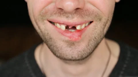 Without teeth Stock-Footage 10915534