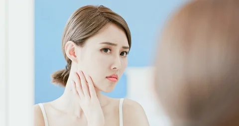 Woman with acne problem Stock Footage 93075232