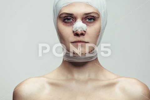 Woman after facial cosmetic surgery Stock Photos