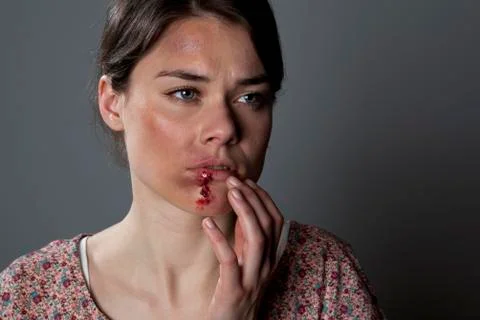 A woman with bruises and bloody lip Stock Photos