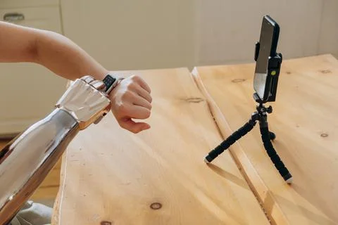 Woman controls bionic arm using smartwatch near phone Stock Photos