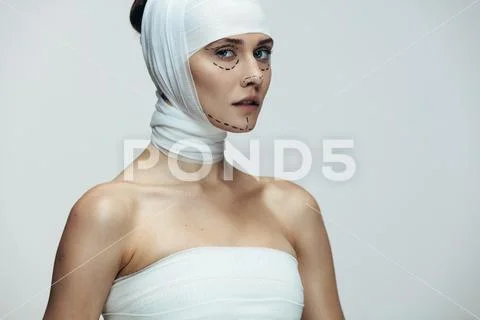 Woman before cosmetic surgery on her face Stock Photos