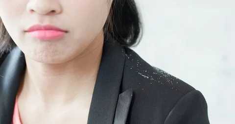 Woman with dandruff problem Stock Footage 90888350