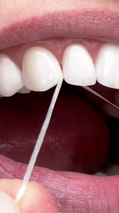 Woman is demonstrating proper flossing technique with white floss between her te Stock Footage 342547207