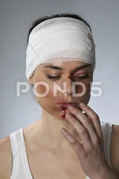 A woman with injuries and a bandhead Stock Photos