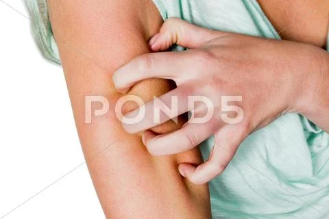 Woman itchy skin Stock Photos