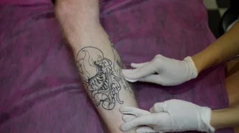 Woman Laser Operator prepares to remove Tattoos from Leg Stock Footage 67349751