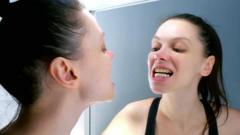 Woman looking at mirror on different teeth lower white veneers and upper yellow. Stock-Footage 167822473