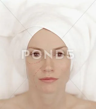 Woman with markings on face in preparation for plastic surgery Stock Photos