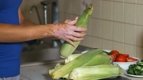 A woman is peeling corn in the kitchen. Vitiligo disease in the hands Stock Footage 159877053