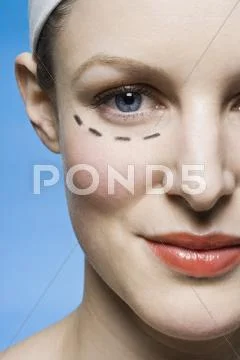 A woman with a plastic surgery guide drawn under her eye Stock Photos
