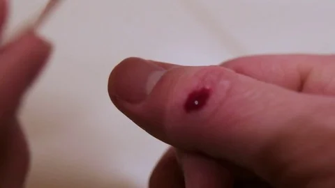 Woman Puts Bandage On Man's Bleeding Thu... | Stock Video | Pond5