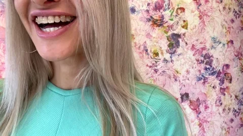 Woman with sapphire braces Stock Footage 166319924