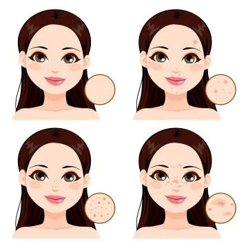 Woman Skin Problems Stock Illustration