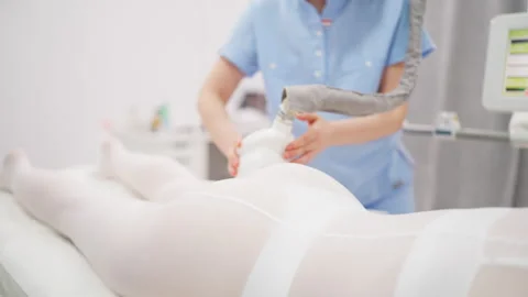 Woman undergoing professional vacuum roller massage focused on body shaping.. Stock Footage 342277040