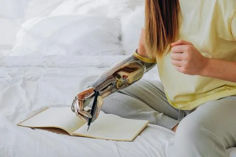 Woman writes in notebook with bionic arm sitting on bed Foto stock