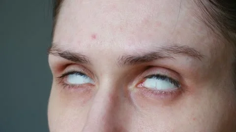 Woman's eyes rolling back into her head Stock Footage 337892236