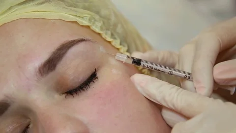 Woman's face close up during Botox injections Stock Footage 83499868