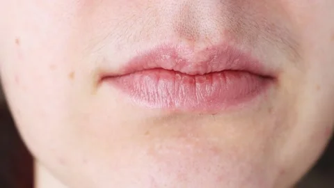 Woman's face close-up with mustache above the lips. Problem skin with hairs. Stock Footage 170476171