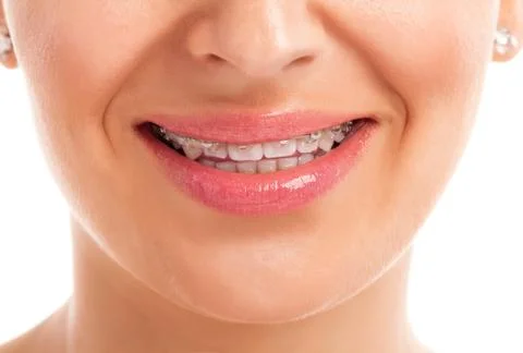 Womans face with denture Stock Photos