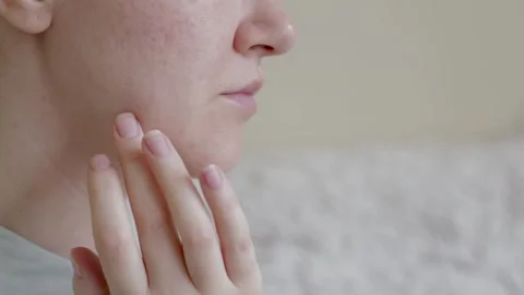 Woman's face in profile with problem skin pigment spots scars scars post acne 스톡 동영상 278348784