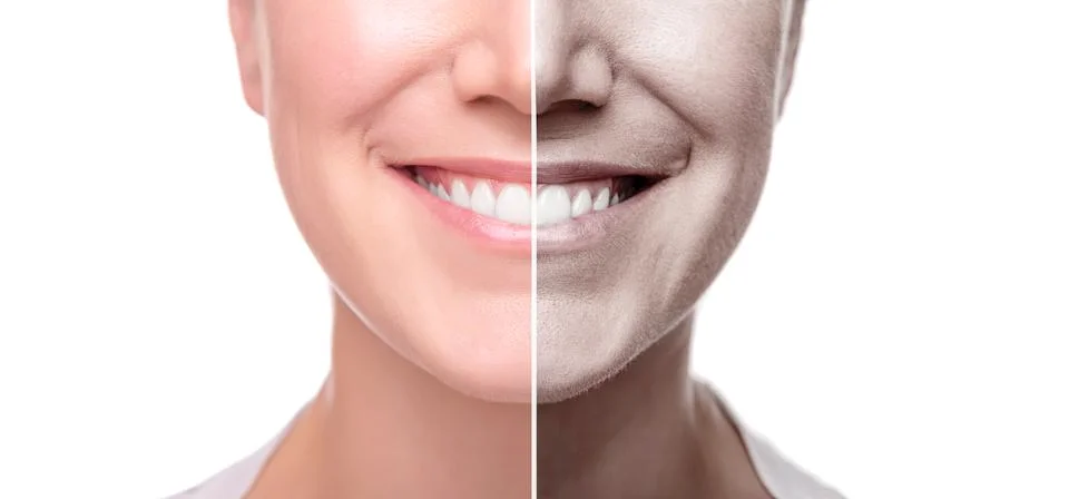 A woman's face is split in half for good and bad skin. Isolated on white Stock Photos