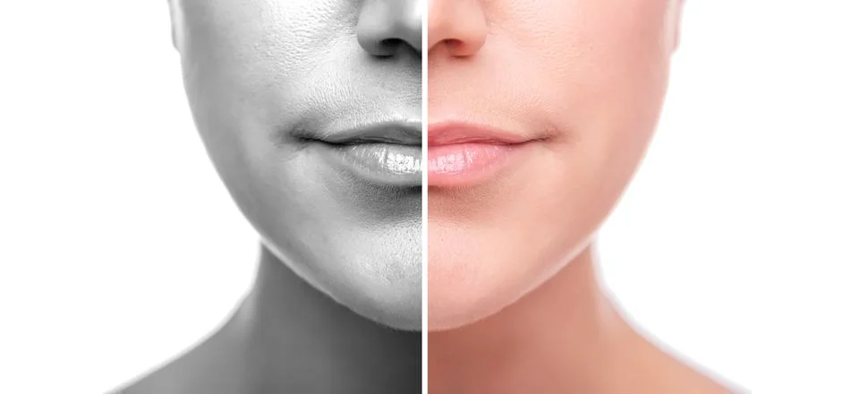 A woman's face is split in half for good and bad skin. Isolated on white Stock Photos