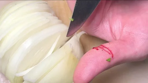 Woman's finger gets cut while chopping onions in home kitchen. Stock Footage 255032612