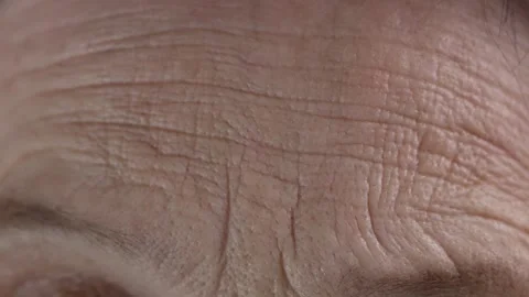 Woman's forehead with deep wrinkles Stock Footage 262883107