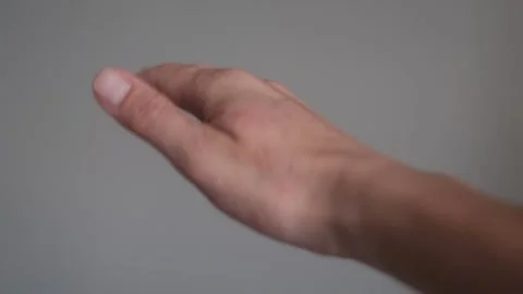 Womans hand eczema Stock Footage 310914268