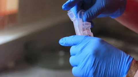 A woman's hand in a glove puts a probe for a dna test Stock Footage 241226329