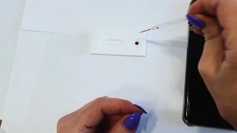 The woman's hands drip a drop of blood and buffer in the Covid19 test. Stock Footage 146751511