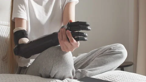 Woman's hands holding artificial arm Stock Footage 102135992