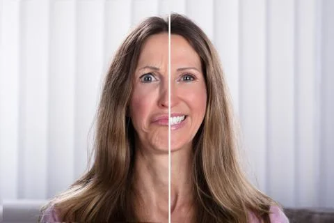 Woman's Split Face With Happy And Sad Emotion Stock Photos
