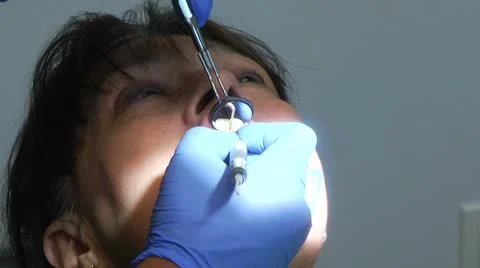 Woman's teeth being cleaned at dentist Stock Footage 8916084